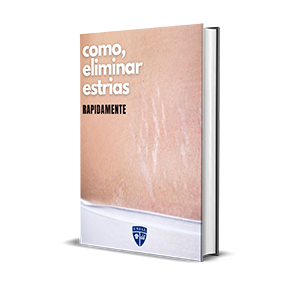 Como Eliminar Estrias